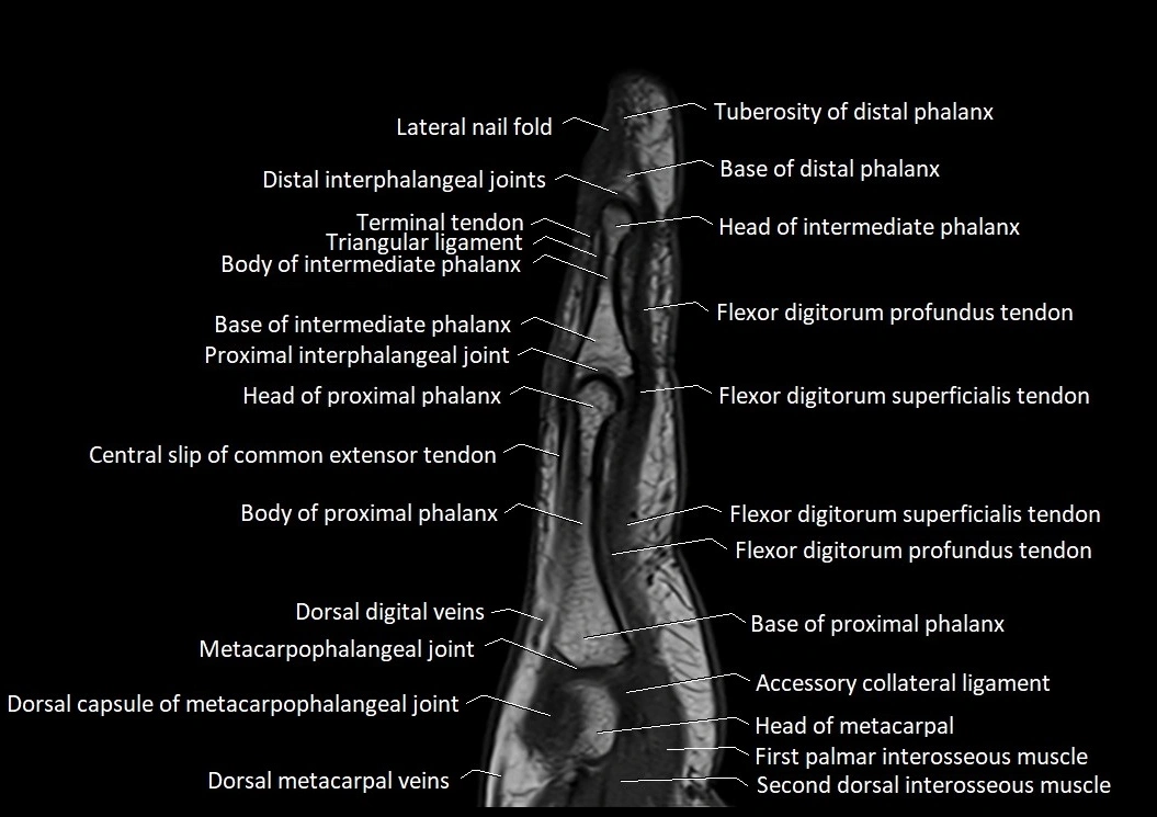 Finger anatomy sagittall cross section 3T image 4.webp